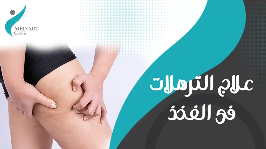 علاج الترهلات فى الفخذ بدون ألم