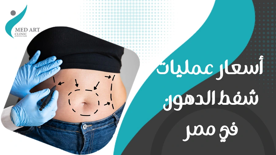 أسعار عمليات شفط الدهون في مصر