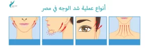 أفضل دكتور لإجراء عملية شد الوجه في مصر