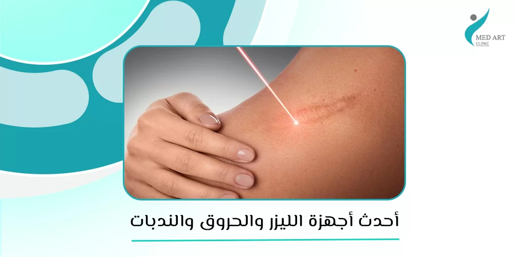 أحدث أجهزة الليزر للحروق والجروح والندبات