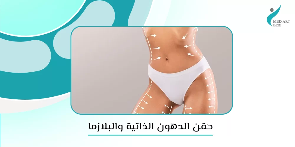 حقن الدهون الذاتية والبلازما