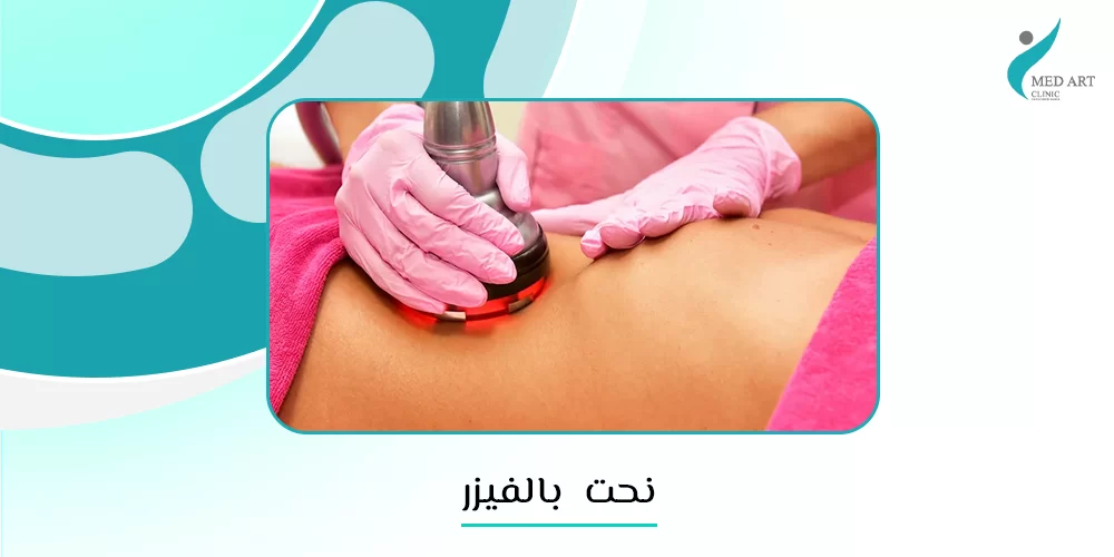 نحت بالفيزر