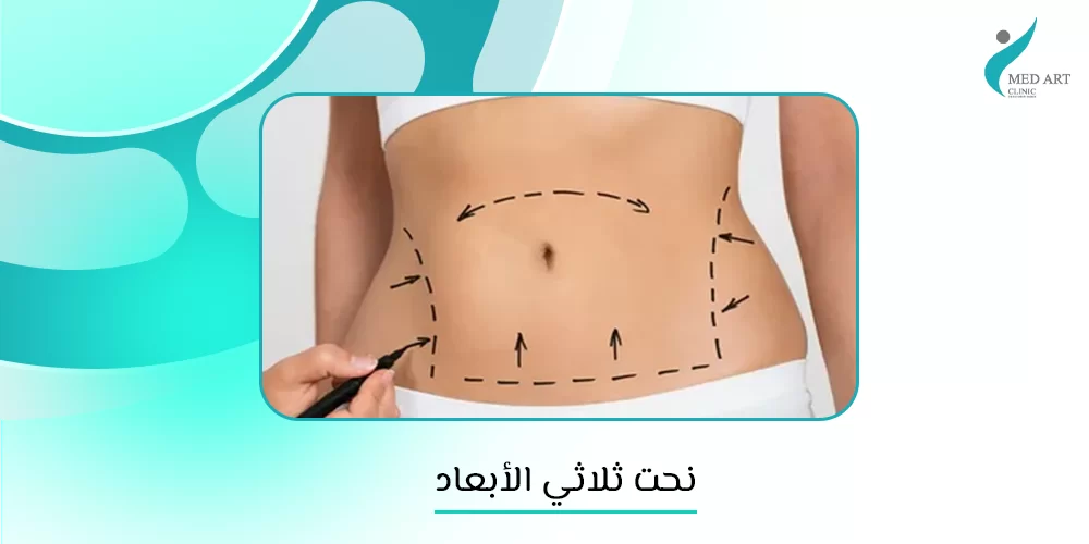 نحت ثلاثي الأبعاد